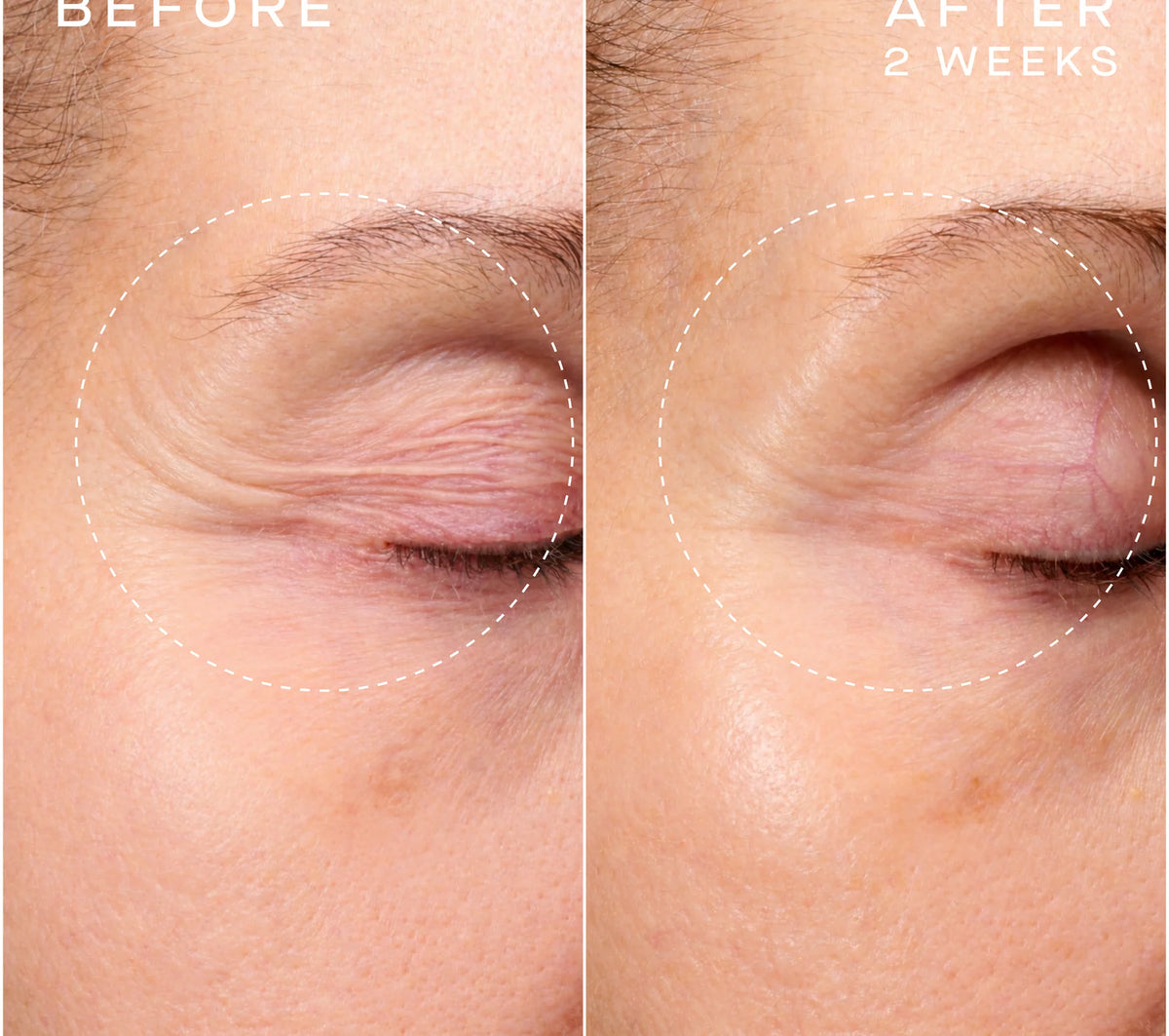 Ourself Advanced Regenerative Serum