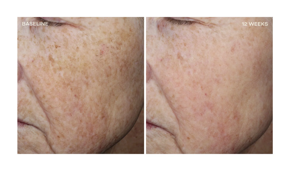 Ourself Complexion Brightening Serum