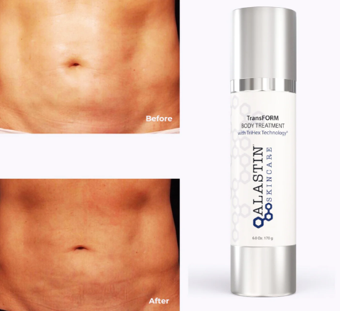 Alastin TransFORM Body Treatment