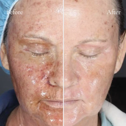 Alastin Regenerating Skin Nectar