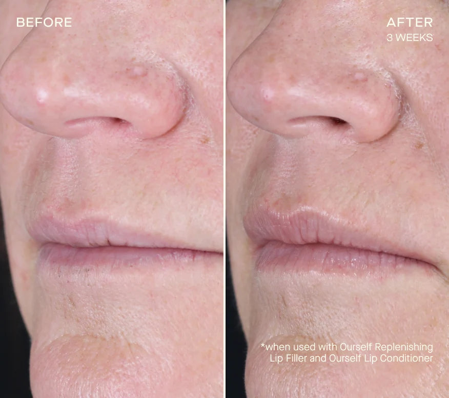 Ourself Replenishing Lip Filler